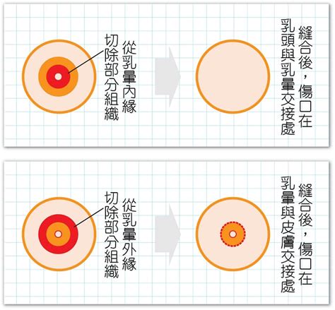 乳暈意思